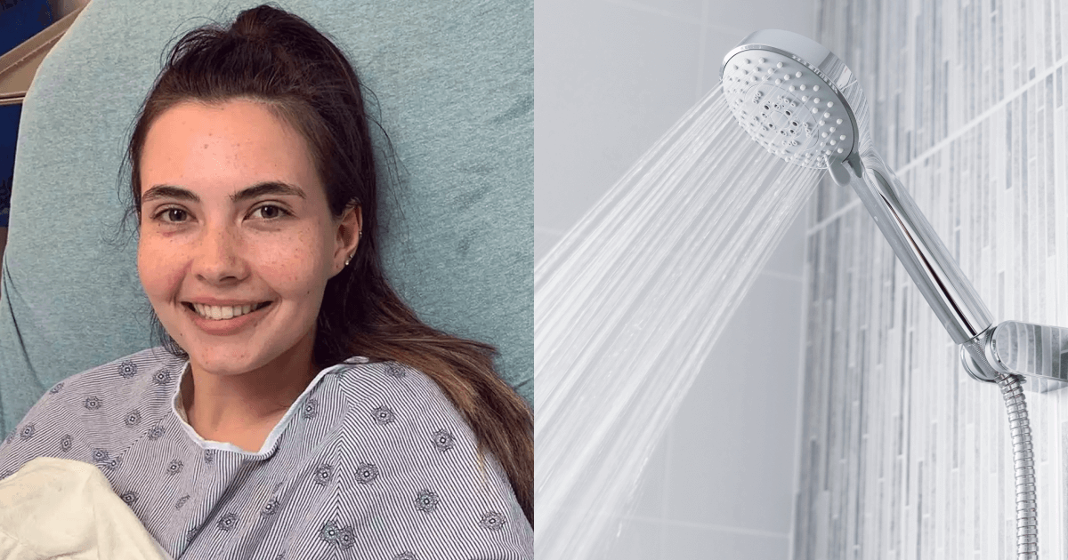 Woman allergic to water says her scalp would bleed after showering